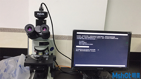 對惡性腫瘤進(jìn)行診斷與鑒別