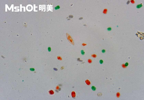 生物顯微鏡ML51-M觀察染色酵母菌