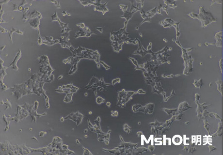 熒光生物顯微鏡應用于ANA-HEp2免疫熒光診斷